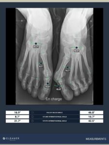 RADIOGRAFIA PIEDE